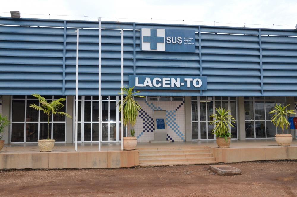 Governo do Tocantins disponibiliza testes RT-qPCR para a covid-19 e outros vírus respiratórios