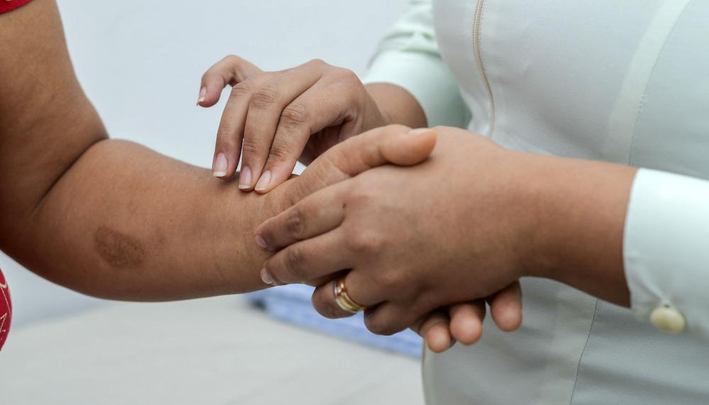 SES-TO alerta para a prevenção e os cuidados contra a Hanseníase