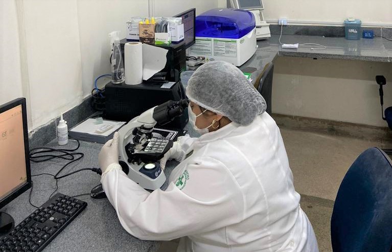 Governo do Tocantins amplia serviços laboratoriais dos hospitais estaduais